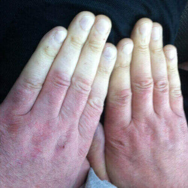 Cliteral version of death grip