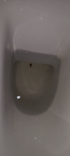 Is this a very early miscarriage? TW: Picture of tissue/miscarriage?