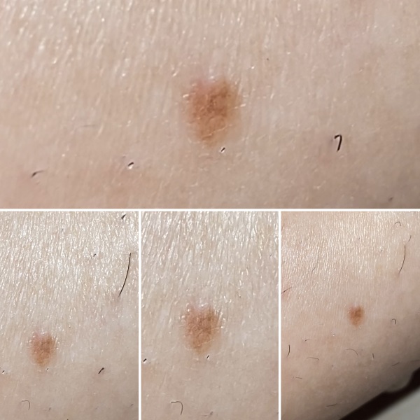 Is my skin or this spot peeling? I don't know, I'm confused!!