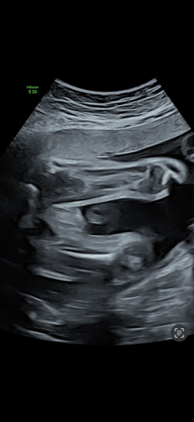 Confusing scan picture