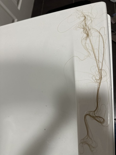 Is this a normal amount of hair loss?!