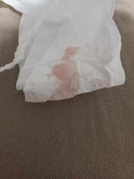 Is this implantation bleeding?