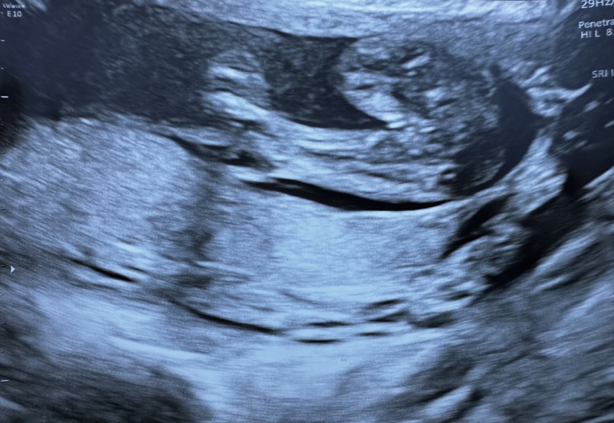 PottyShot. Girl or Boy?!