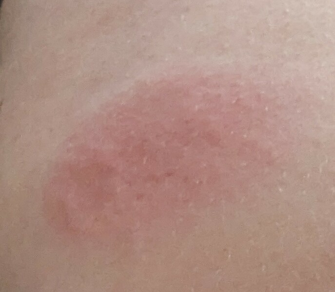 To worry about getting covid and flu jab on the same day?
