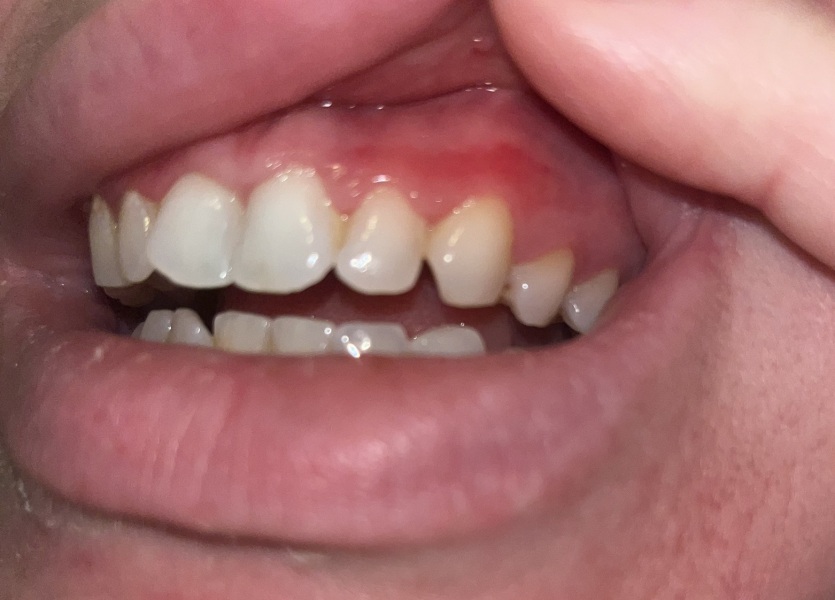 What's on my gum?!