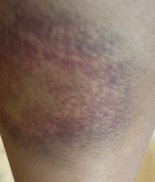 Can anyone tell what this mark is?