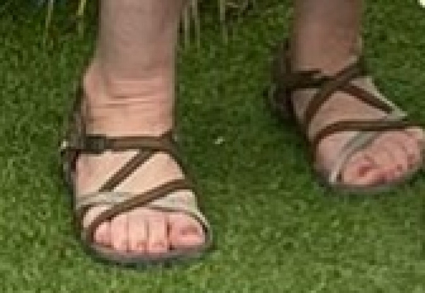 Wrinkly ankles - why?