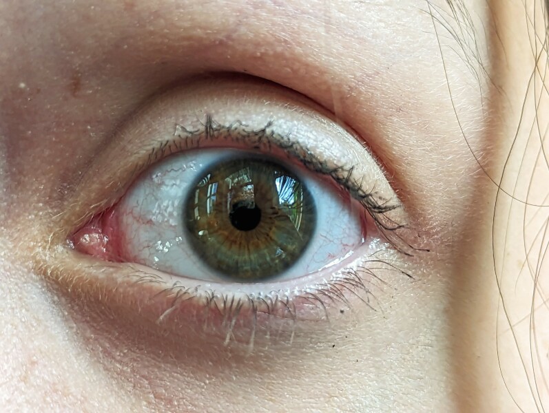 What colour is this eye?