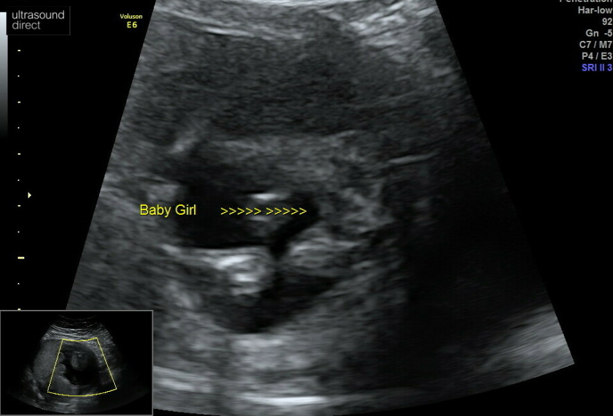 Is this deffo a girl?!