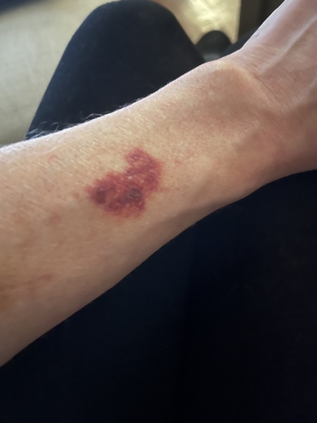 What do you think this is?