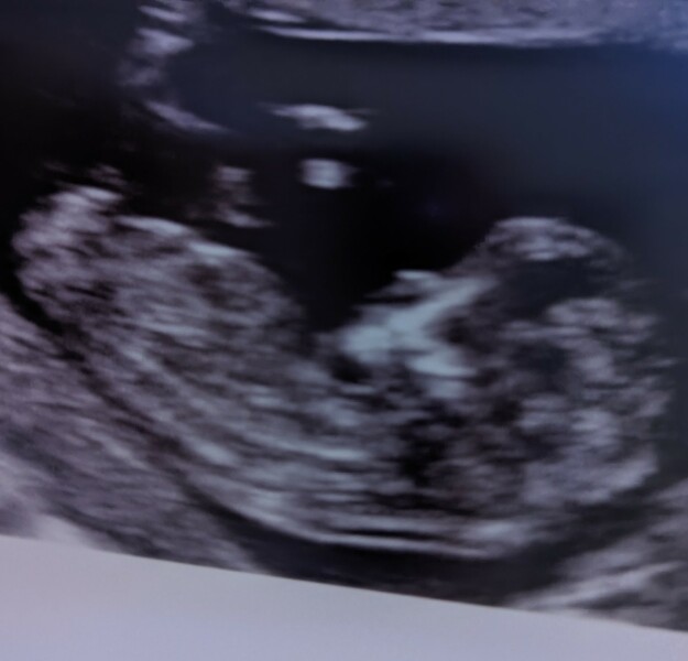 Any guesses - boy/girl
