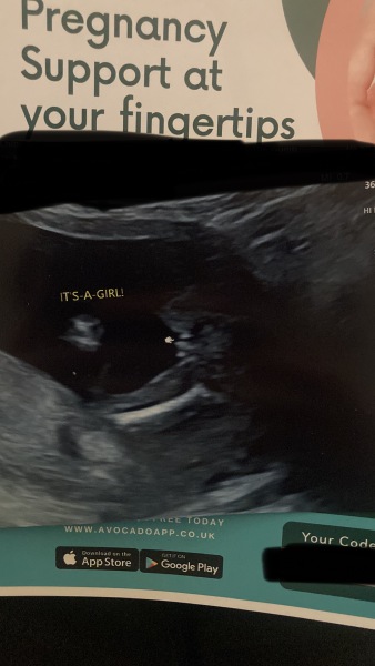 Wrong gender at 16 weeks
