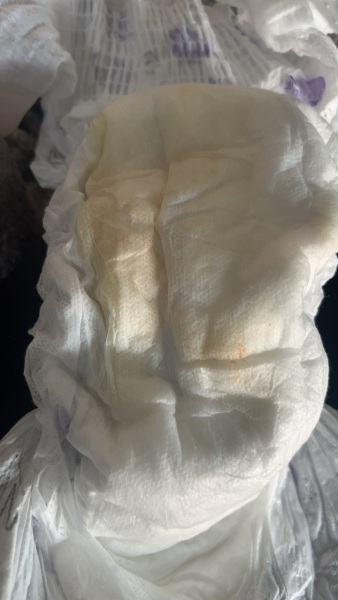 Orange colour in 8m old nappy when poorly