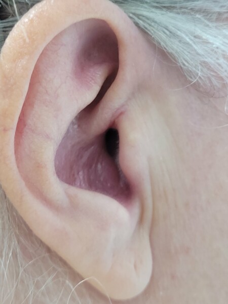 CLAXON - ear pic - sore ear - infection?   Doctor or wait?