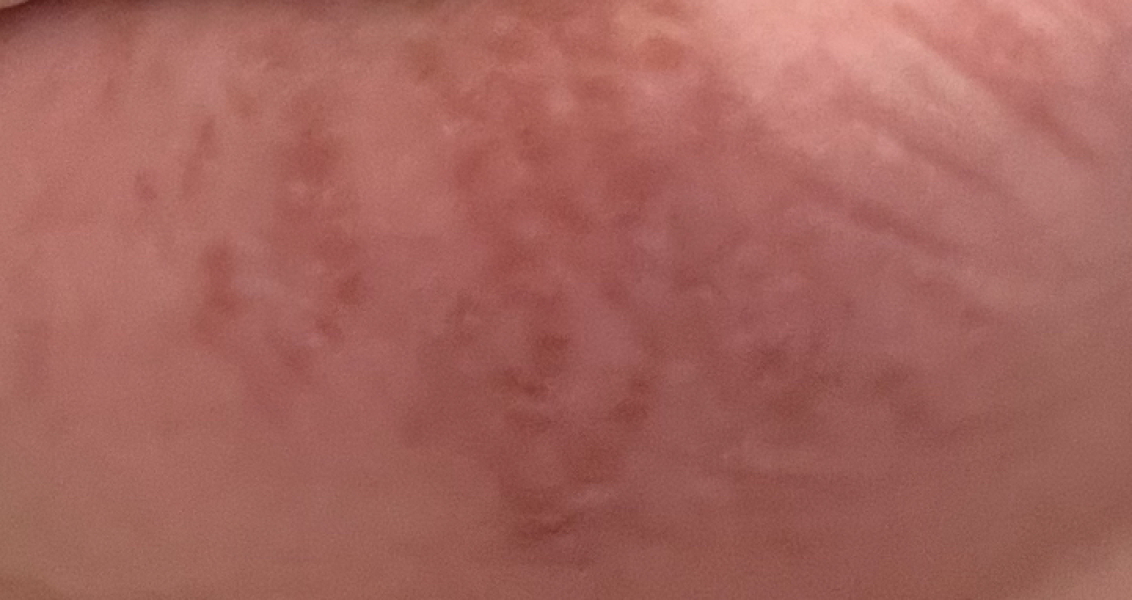 ERA/Alice/Emma infertility thread graduates/pregnancies