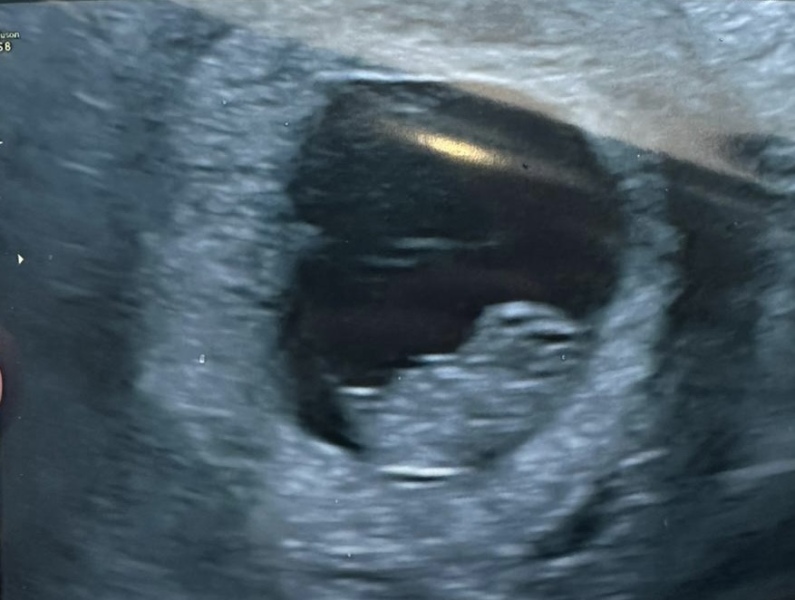 Due May 2024? Part 2