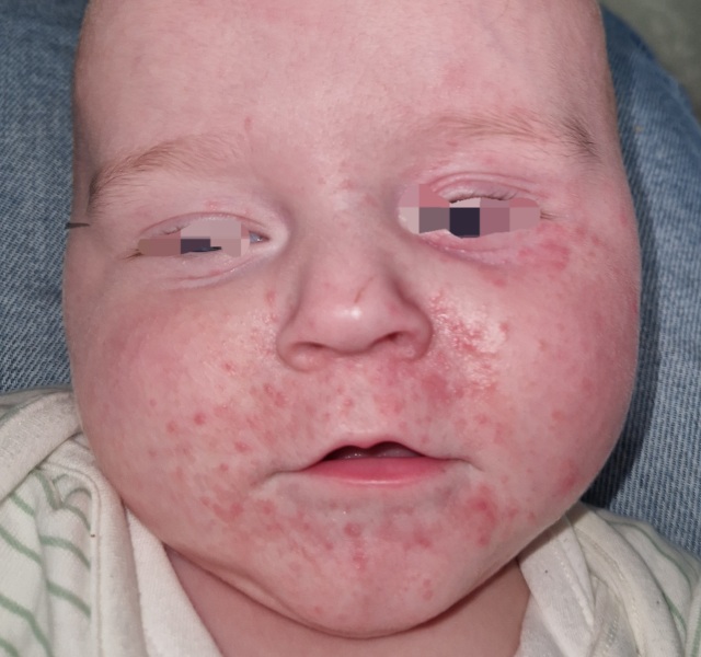 Any idea what these spots / rash is?