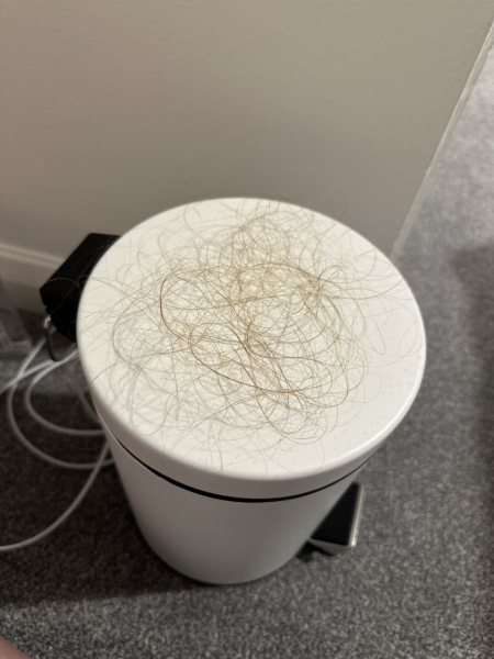 Is this a normal amount of hair loss?!