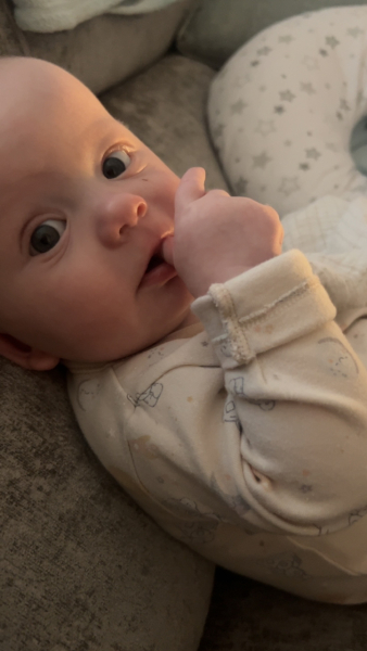 Lines/folds under baby's eye? Picture attached