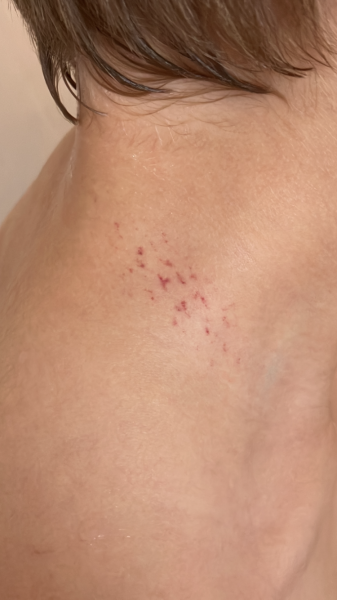 What is this child’s neck injury?