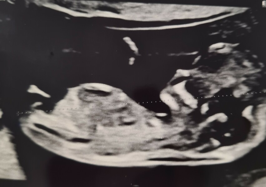 Just had my 12 week scan, any guesses?