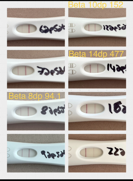 Fresh IVF cycle Negative test at 6dp5dt