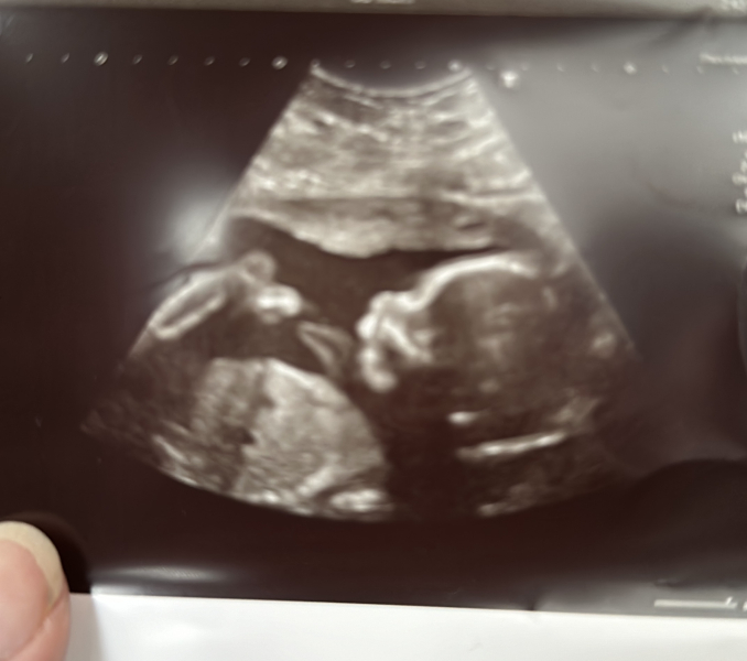 March 2024 second trimester onwards