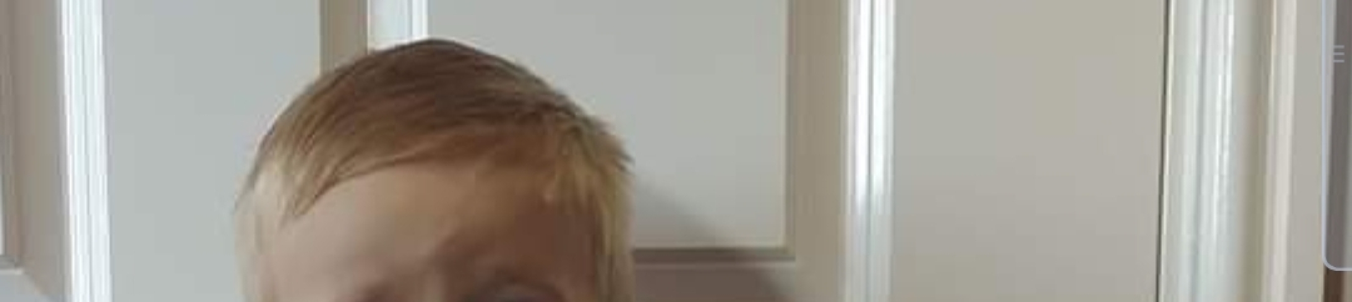 Forehead Lump - Really worried!