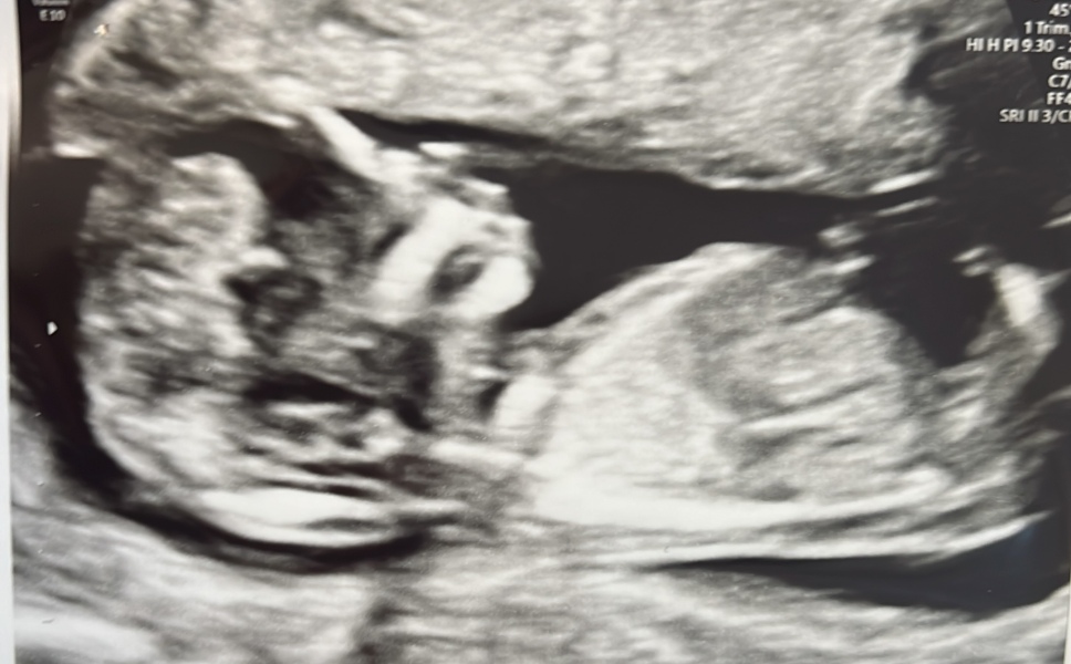 Boy or girl