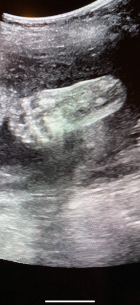 Come and tell me your dull and unexciting news 26: Calmly through the day 