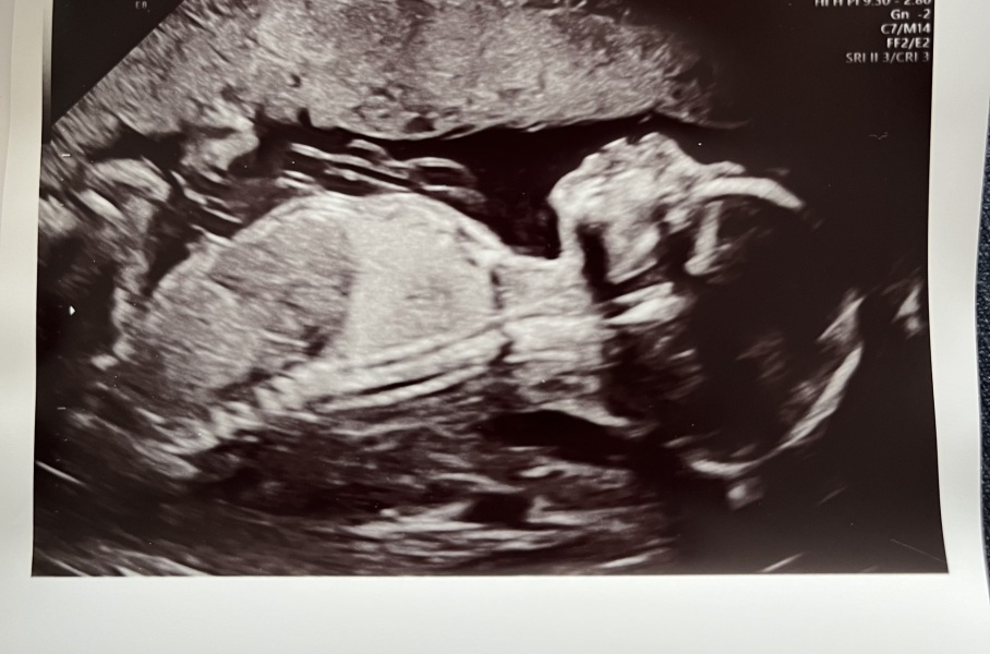 Gender guesses please!