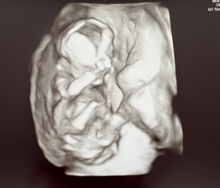 Gender scan 3d image