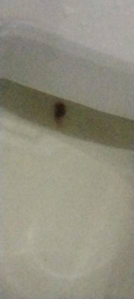 Is this a very early miscarriage? TW: Picture of tissue/miscarriage?