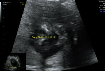 Is this deffo a girl?!