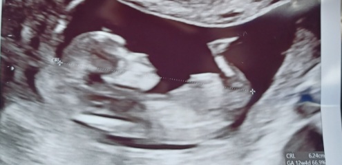Boy or girl