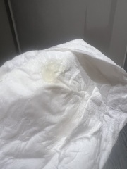 Bleeding 5days past ovulation