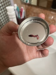 Is this a miscarriage? Please help. TRIGGER WARNING : PHOTOS