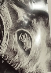 Ramzi/nub theory for baby's sex? just for fun