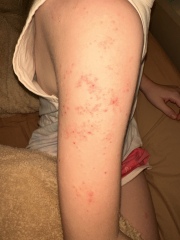 Anyone know what this rash could be