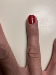 Getting rings cut off