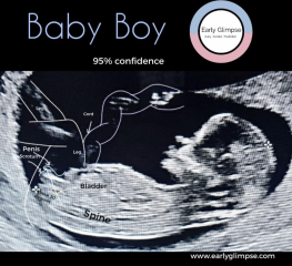 Has anyone had nub theory be wrong?