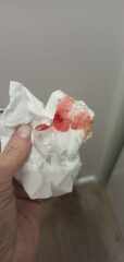 Is this implantation bleeding?