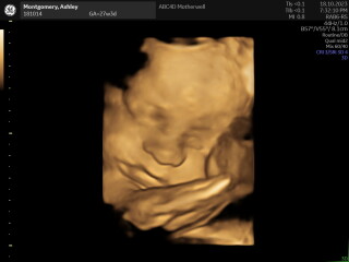 Due January 2024, Part 7!