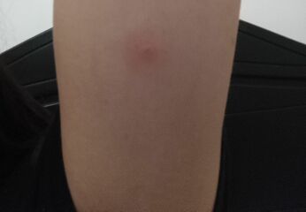 What has bitten me? (Pics)
