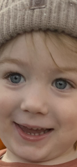 Lines/folds under baby's eye? Picture attached