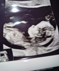 Boy or Girl