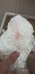 Is this implantation bleeding?