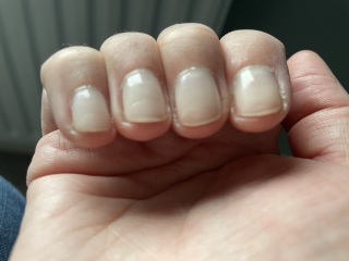 Nails filed too thin with drill, ouch