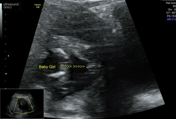 Is this deffo a girl?!