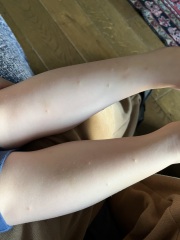 Any ideas on these little hard spots that have appeared?